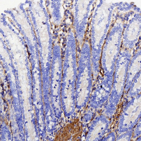 Immunohistochemistry (antigen was repair with 0.4% pepsin for 20 min) analysis of paraffin-embedded Rat colon  using COL1A1 Polyclonal Antibody at dilution of 1:500.