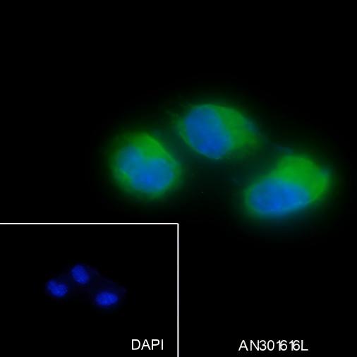 Recombinant ARPC5/p16 ARC Monoclonal Antibody - small - 4
