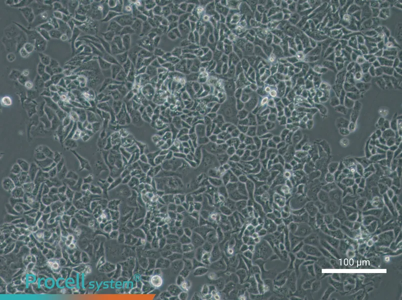 NCI-H522[H522]NCI-H522[H522] - 2