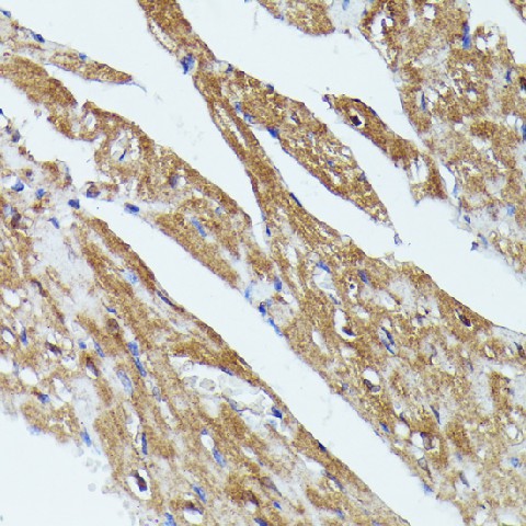 Immunohistochemistry of paraffin-embedded Mouse heart using TBCB Polyclonal Antibody at dilution of  1:100 (40x lens).