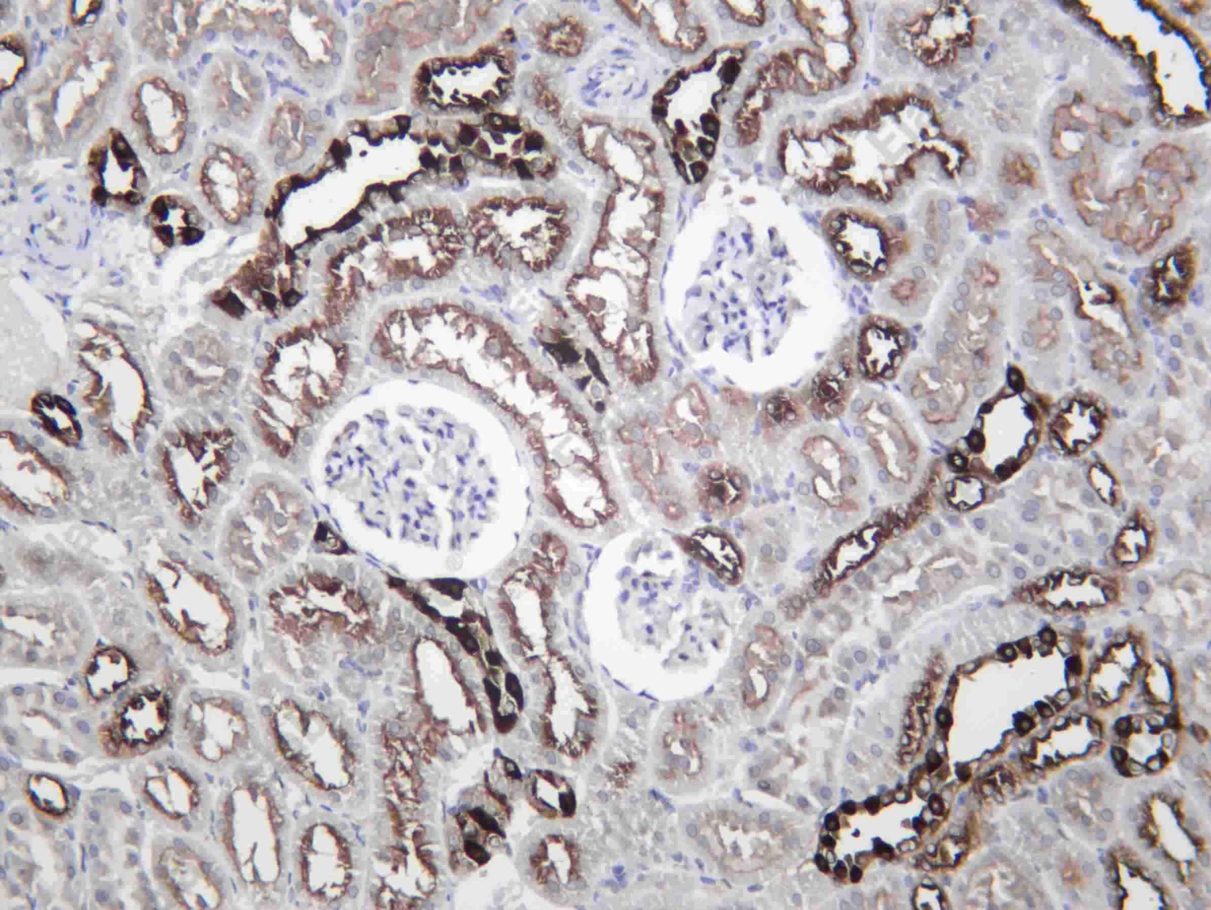 Recombinant V ATPase B1 Monoclonal Antibody - 3