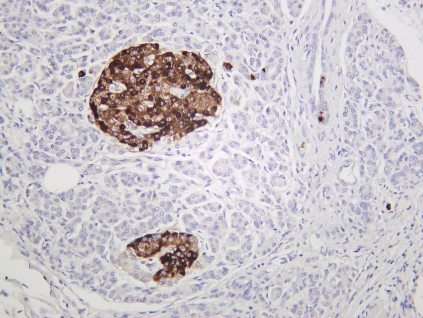 Recombinant Chromogranin A/CHGA/CGA Monoclonal Antibody - 3