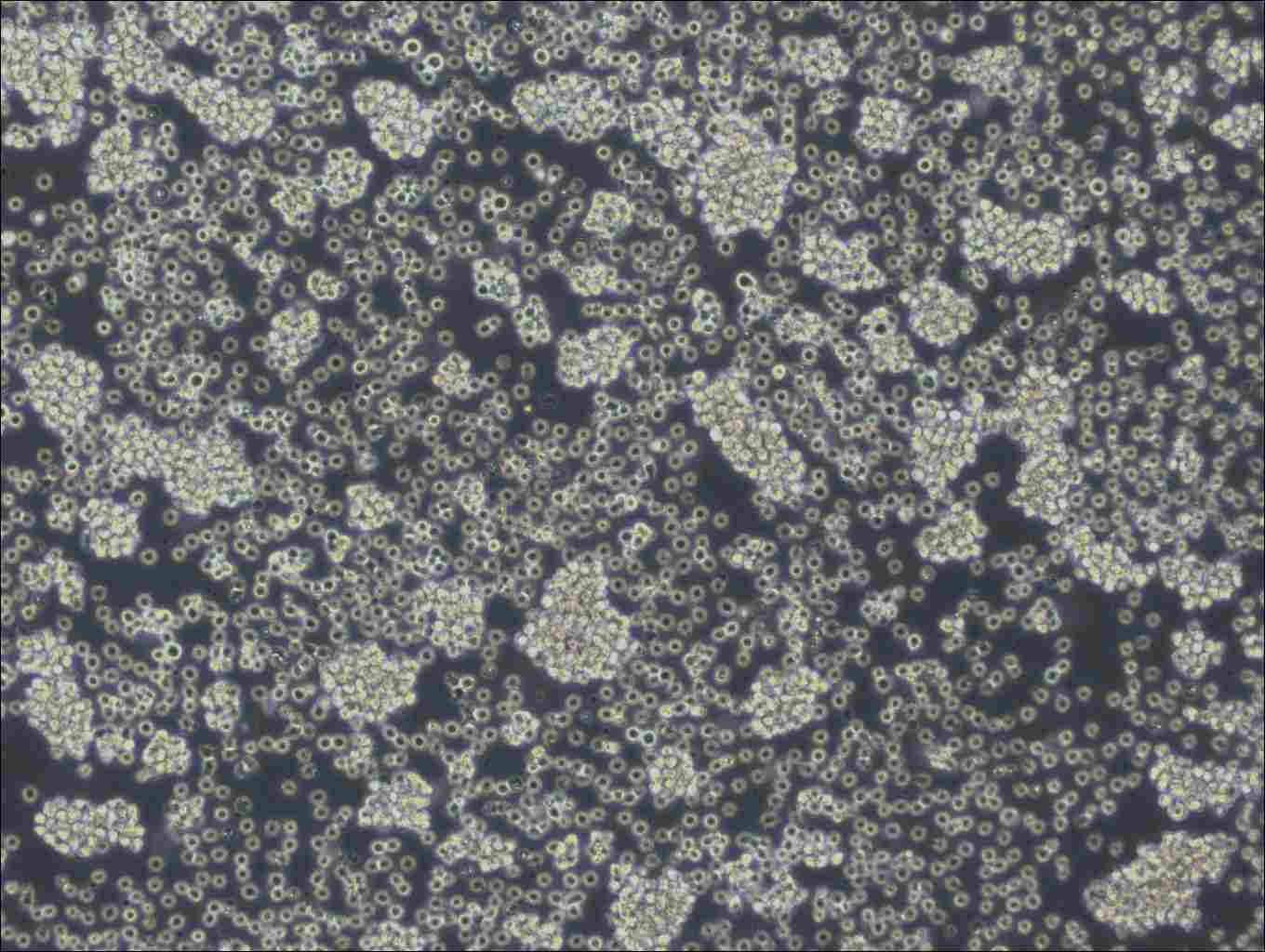 WSU-DLCL2 Cell Complete Medium - 2