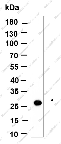 Recombinant CTRP2 Monoclonal Antibody - 1