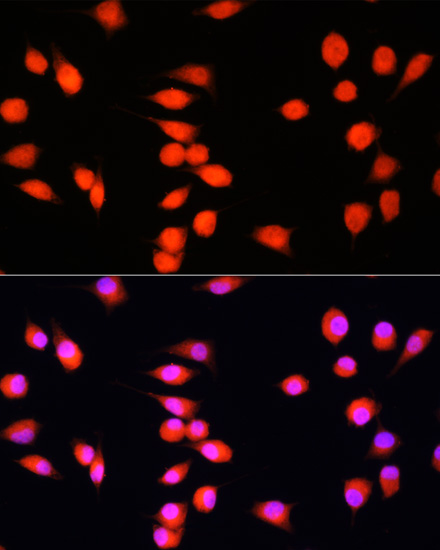 Immunofluorescence analysis of L929 cells using COMMD1 Polyclonal Antibody at dilution of  1:100. Blue: DAPI for nuclear staining.