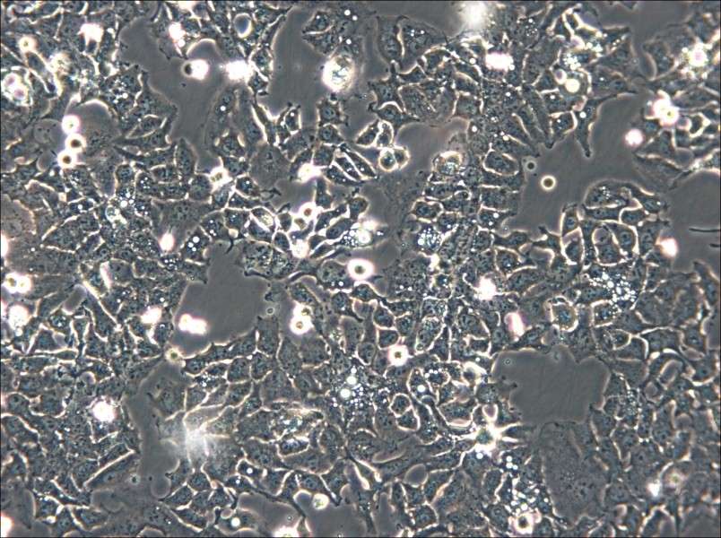 Ishikawa Cell Complete Medium - small - 6