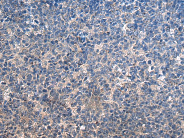 Immunohistochemistry of paraffin-embedded Human tonsil tissue  using HSPA5 Polyclonal Antibody at dilution of 1:35(?200)