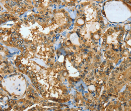 ANXA3 Polyclonal Antibody - 3