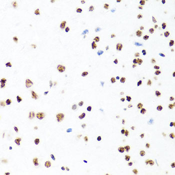 Immunohistochemistry of paraffin-embedded Mouse brain using Histone H1.0 Polyclonal Antibody at dilution of 1:100 (40x lens).