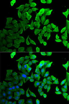 Immunofluorescence analysis of U2OS cells using SEPT2 Polyclonal Antibody