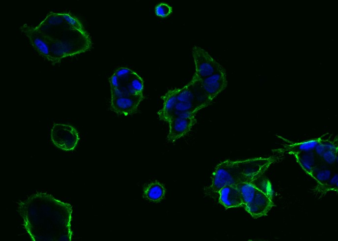TROP2/TACSTD2 Monoclonal Antibody - small - 10