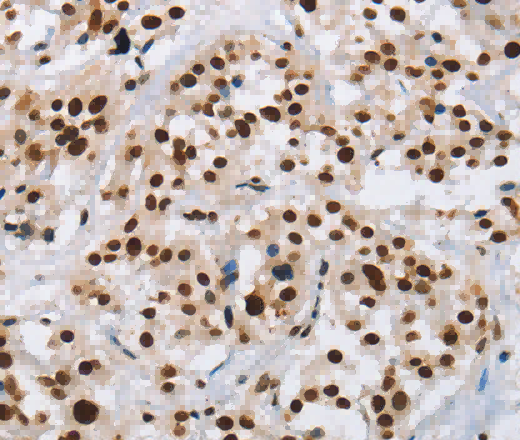 IL17C Polyclonal Antibody - 3