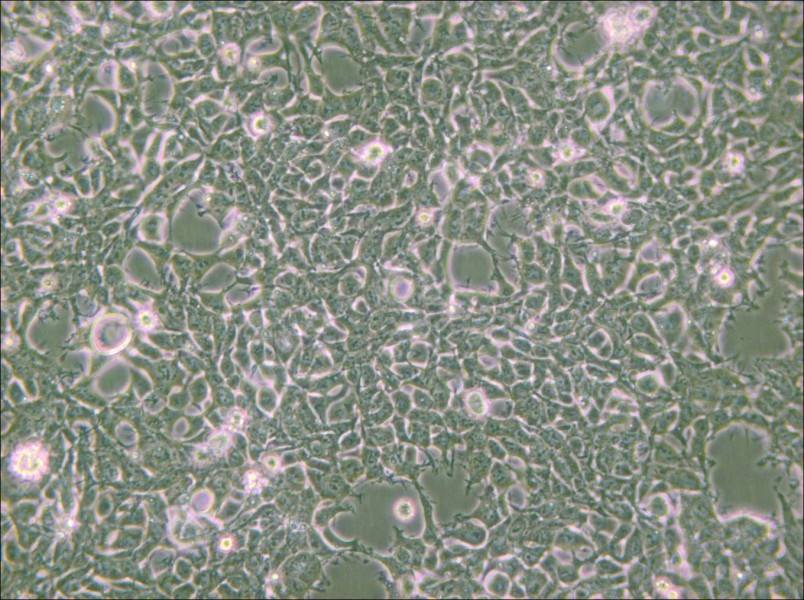 2V6.11 Cell Complete Medium - 6