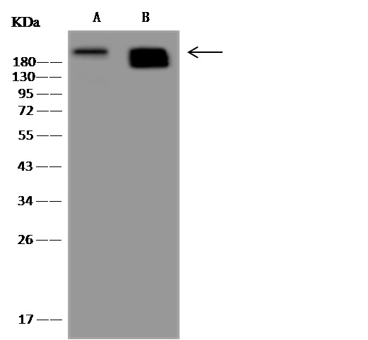 Nestin/NES Monoclonal Antibody - small - 5