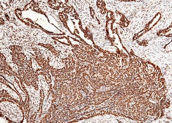 CCNE1/Cyclin-E1 Monoclonal Antibody - 2