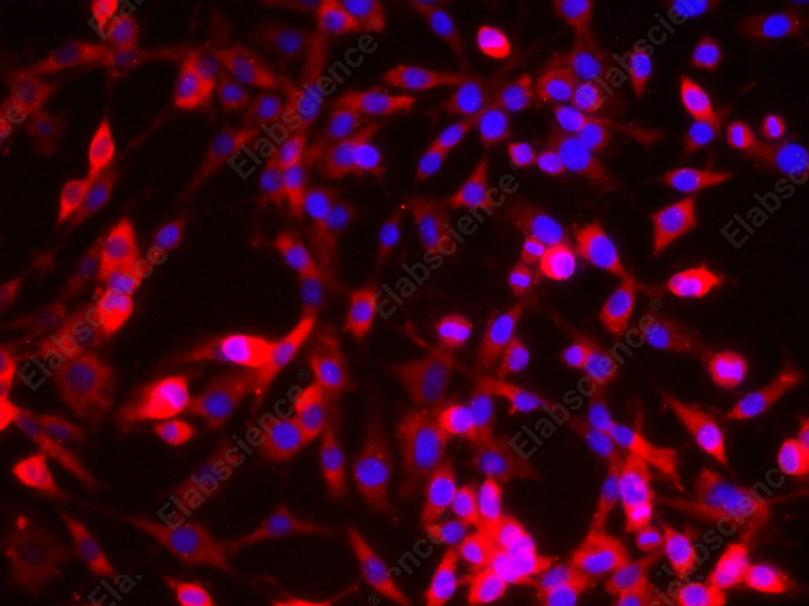 EEF2 Polyclonal Antibody - 6
