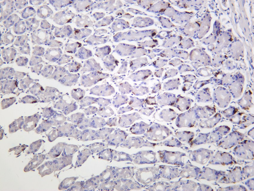 Recombinant Chromogranin A/CHGA/CGA Monoclonal Antibody - small - 4