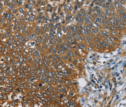 CAST Polyclonal Antibody - 2