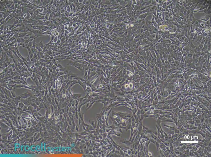 Rat Coronary Artery Smooth Muscle Cell Complete Medium - 1