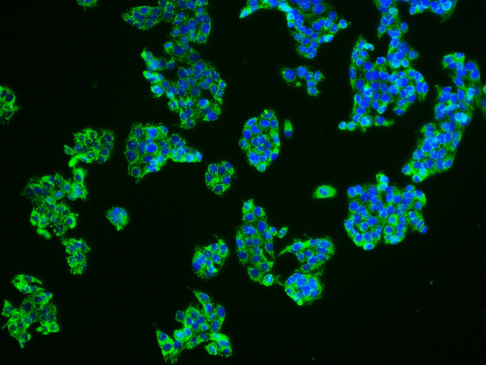 HSP-60 Polyclonal Antibody - small - 7