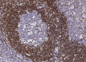 Recombinant Bcl-2 Monoclonal Antibody - small - 2