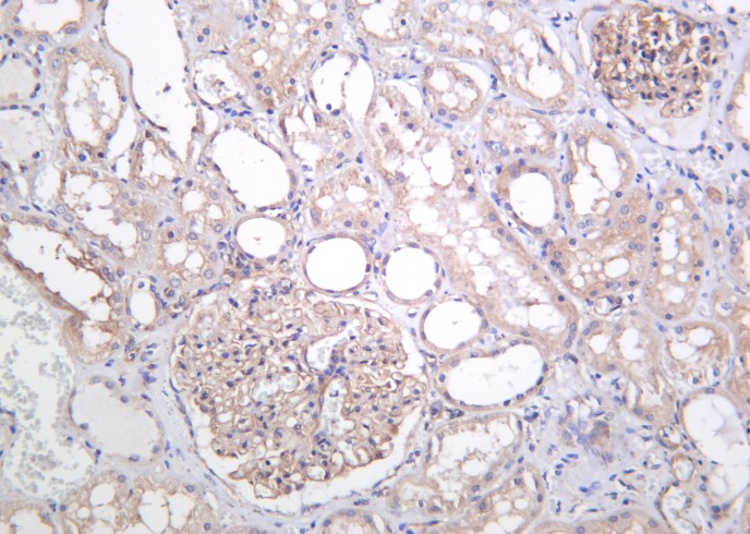 Recombinant TXNIP Monoclonal Antibody - small - 2