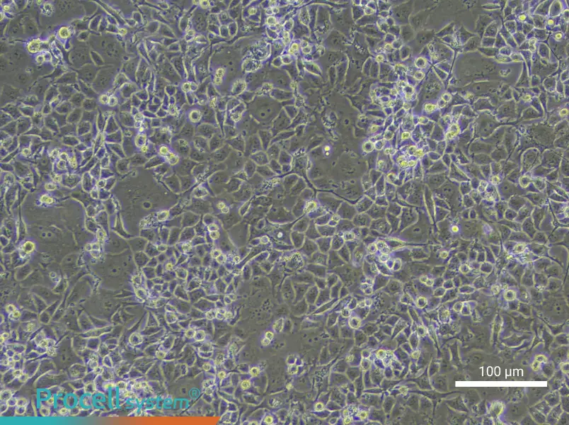 Human Bronchial Epithelial Cell Complete Medium - 2