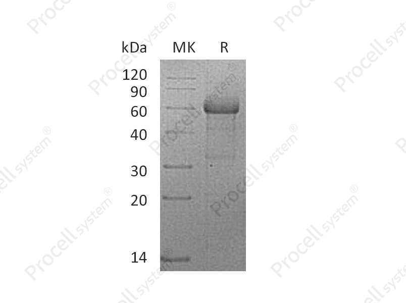 TNF-R2/CD120b/TNFRSF1B (C-mFc), Human, Recombinant