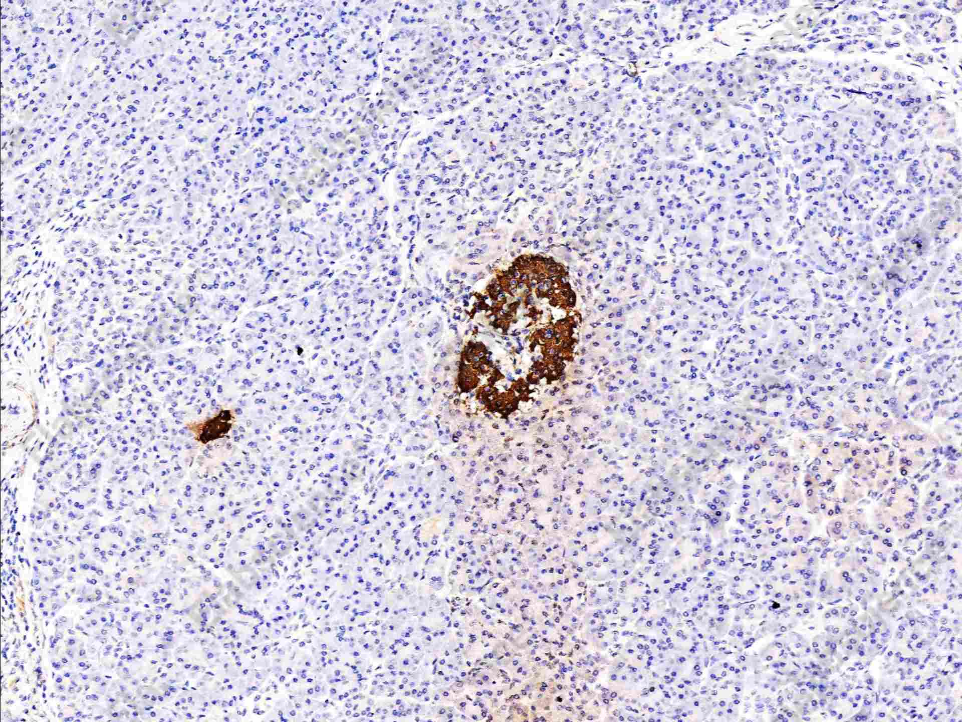 Recombinant Insulin Monoclonal Antibody - 2