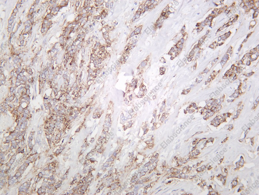 Recombinant Claudin-1 Monoclonal Antibody - 6