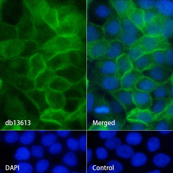Recombinant BCAM/CD239 Monoclonal Antibody - 2