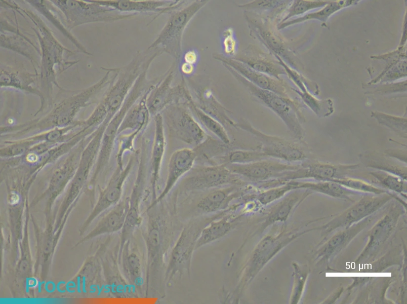 Human Oral Mucosal Fibroblast Complete Medium - small - 4