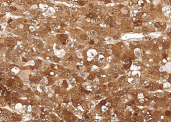 GOT2 Monoclonal Antibody - small - 2