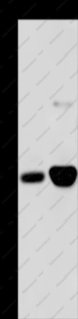 MAPRE3 Polyclonal Antibody - 1
