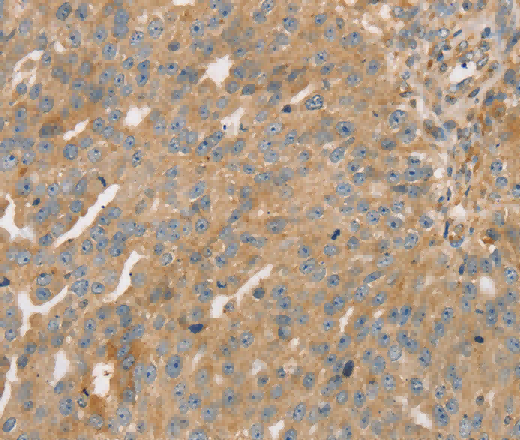 STX16 Polyclonal Antibody - 3