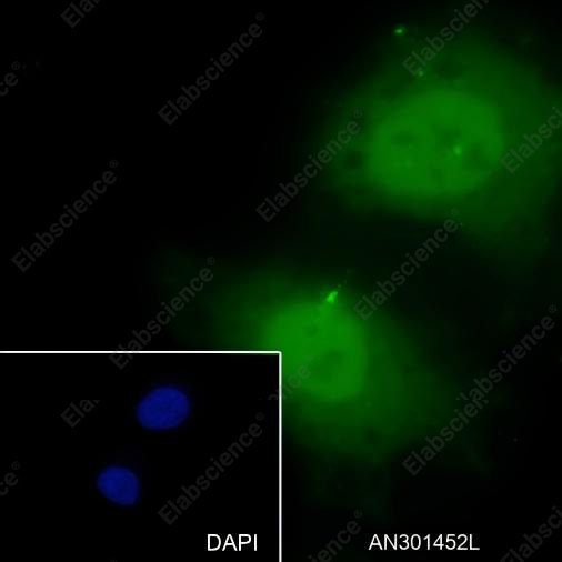 Recombinant Caldesmon/CDM Monoclonal Antibody - 5