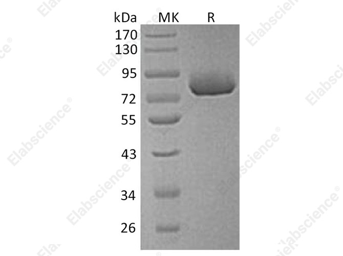 Recombinant Human XPNPEP2 Protein (His Tag) - 1