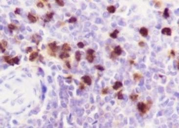 Recombinant S100A9 Monoclonal Antibody-searchlist-2