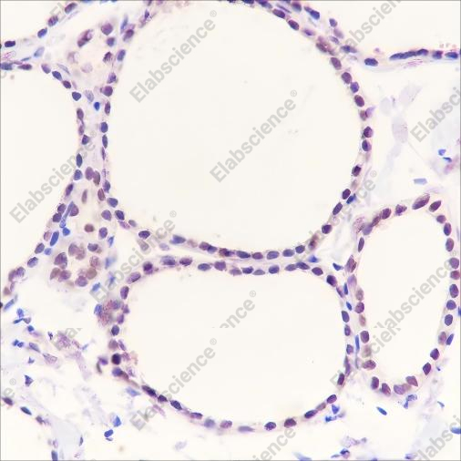 Recombinant PAX8 Monoclonal Antibody - 1