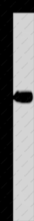 HSD17B13 Polyclonal Antibody - 1