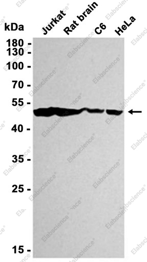 Recombinant ENO1 Monoclonal Antibody - 2