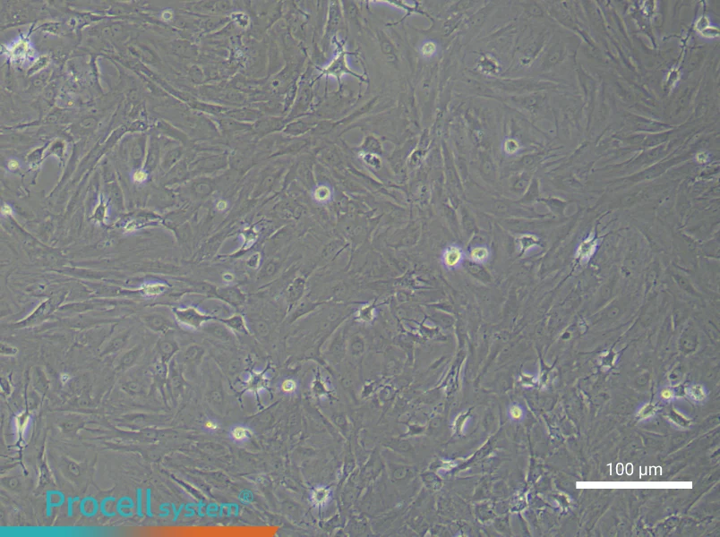 Rat Retinal Muller Cell Complete Medium - 1