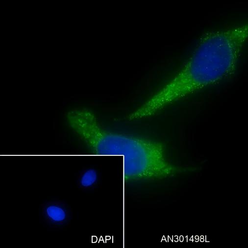Recombinant Cpn10 Monoclonal Antibody - small - 4