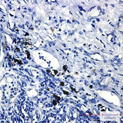 Recombinant Smad2 Monoclonal Antibody - 4