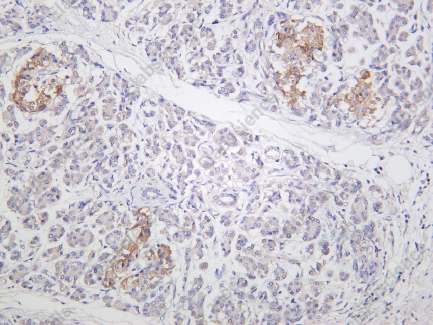 Recombinant STAT3 Monoclonal Antibody - 3
