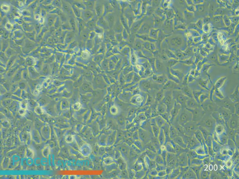 KYSE-450 Cell Complete Medium - small - 4