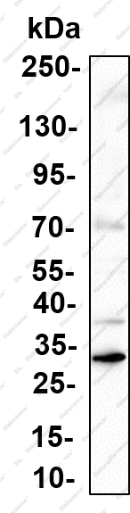 Recombinant KHK Monoclonal Antibody - 1