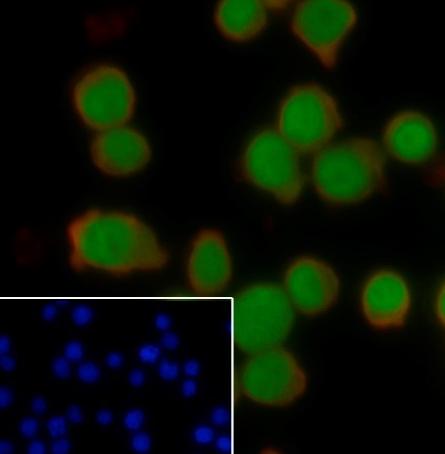 Recombinant SATB1 Monoclonal Antibody - small - 5