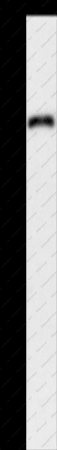 APEH Polyclonal Antibody - 1