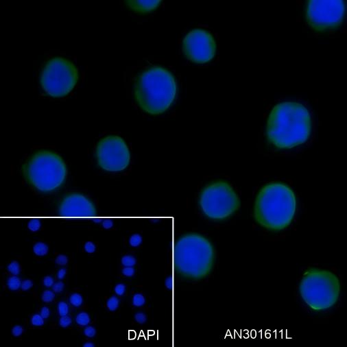 Recombinant NSE Monoclonal Antibody - 3